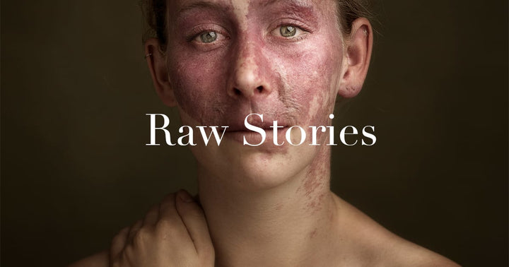 Raw Stories - tofacetheworld